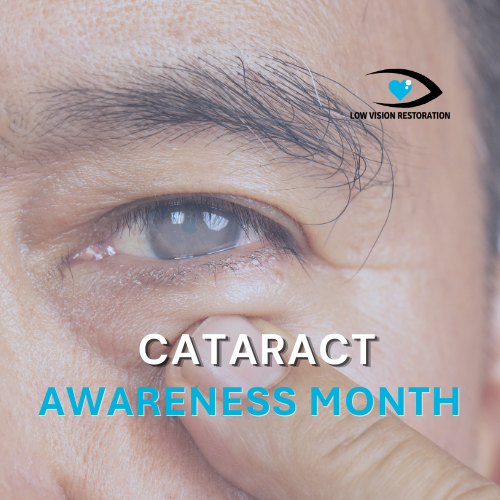 Cataract Awareness Month: What You Need to Know About Cataracts and Your Vision